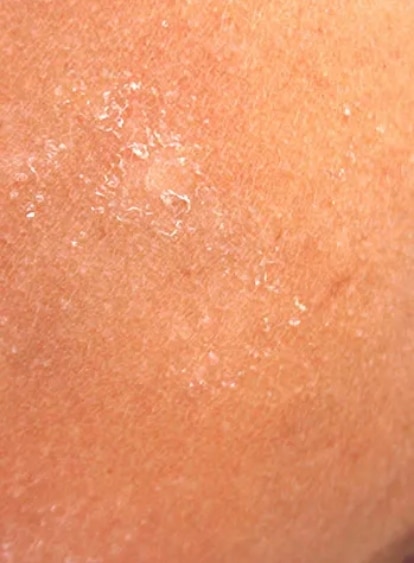 Dull, Dry Skin featured image